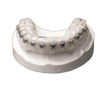 Bracket locator